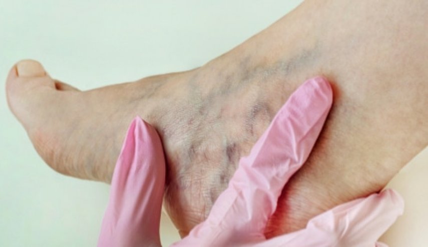  الجلوس على الكرسي أكثر من خمسين دقيقة متواصِلة قد يُسبِّب جلْطات