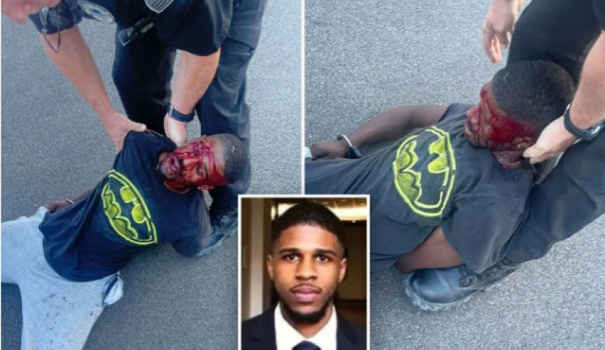 حمله نژادپرستانه پلیس آمریکا به جوانی سیاهپوست در تنسی