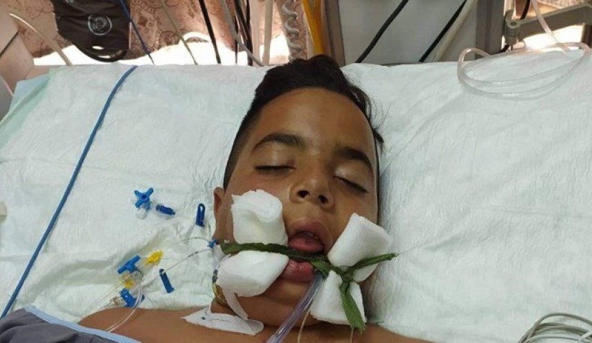 شهادت کودک فلسطینی بر اثر شدت جراحات وارده در جنین + عکس
 