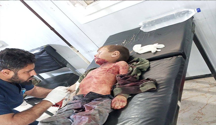 بالصور.. إصابة 3 اطفال بانفجار لغم قرب قاعدة اميركية بدير الزور