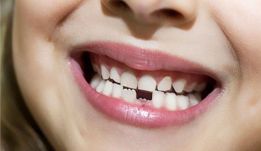 قريبا.. دواء ياباني يعيد نمو الأسنان المفقودة