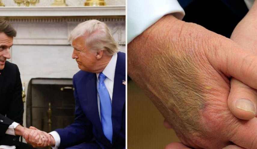 كدمة على يد ترامب تثير الجدل.. والبيت الأبيض يوضح