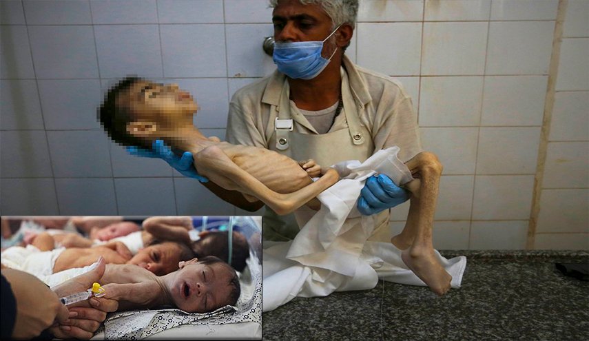 الأورومتوسطي: 26 فلسطيناً قضوا بسبب التجويع في غزة خلال 24 ساعة 