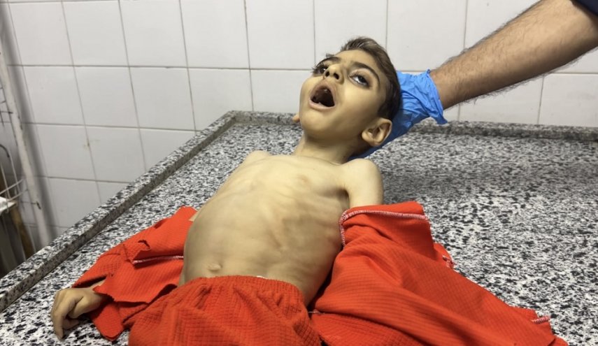 'سلاح التجويع' الصهيوني يودي بحياة طفل في غزة