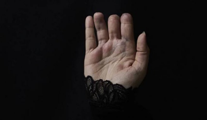 بالصور..شهادات 6 ناجين من انفجار البيجرات تهز لبنان