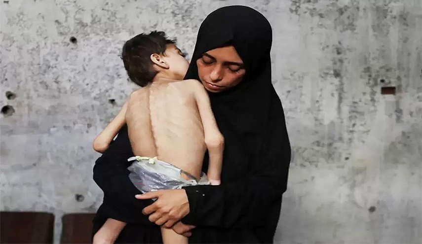  ضحايا مجاعة غزة ترتفع إلى 266 شهيدا منذ بدء الإبادة