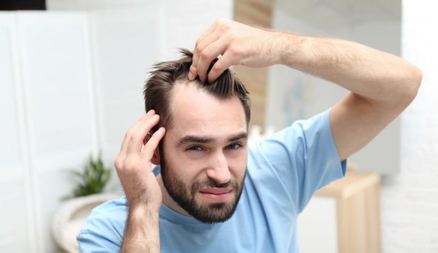 مشروب شائع قد يزيد تساقط الشعر لدى الرجال