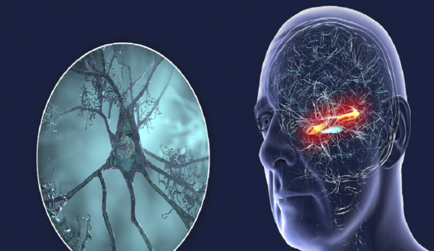 أداة جديدة تتنبأ بخطر ألزهايمر قبل سنوات من ظهور الأعراض