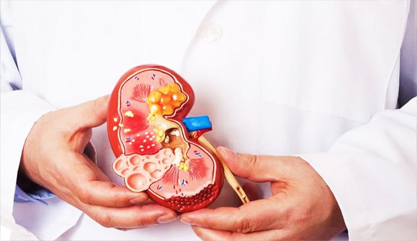 الأطعمة النباتية تقلل مخاطر الإصابة بمرض الكلى المزمن