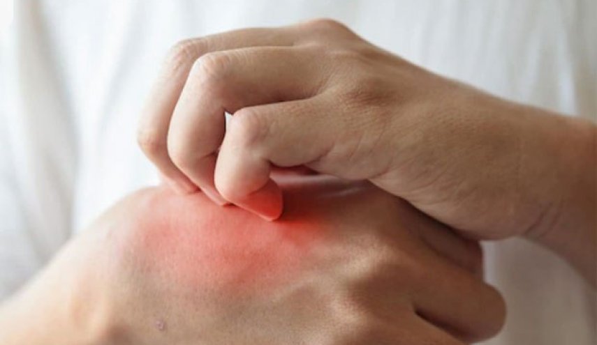 ما علاقة الحكة بأمراض الكبد؟