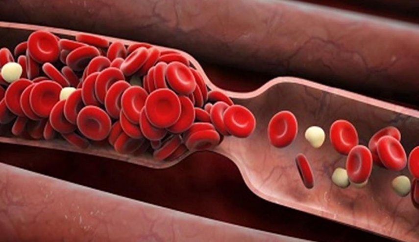 ارتفاع الهيموغلوبين.. هل يشكل خطرا على صحتك؟