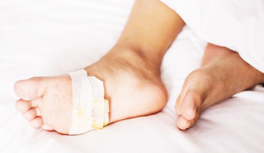 تطوير 'جل' لمرضى السكري يمنع بتر الأطراف