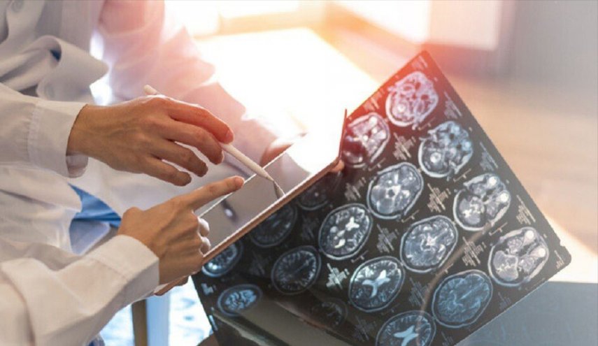 دراسة: بروتين يقلل خطر إصابة الناجين من السرطان بالخرف