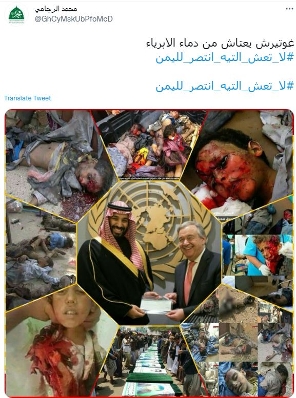 国連はイエメンの子供たちに対する侵略連合の犯罪のパートナーです