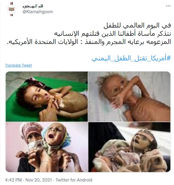 في اليوم العالمي للطفل.. 'أميركا تقتل الطفل اليمني'