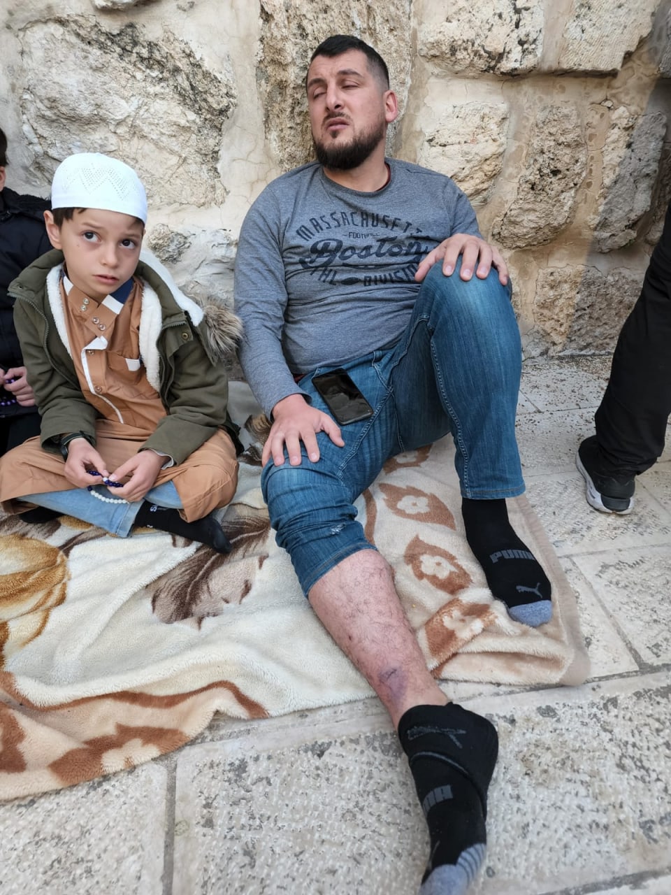 آثار إصابة الزميل الصحفي محمد سمرين إثر اعتداء قوات الاحتلال على الفلسطينيين في المسجد الأقصى