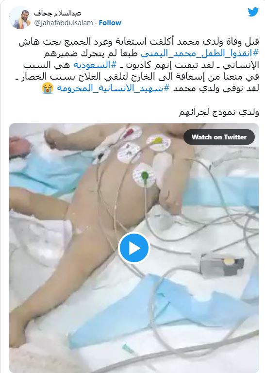 ناشط يمني يتهم السعودية بقتل طفله الرضيع