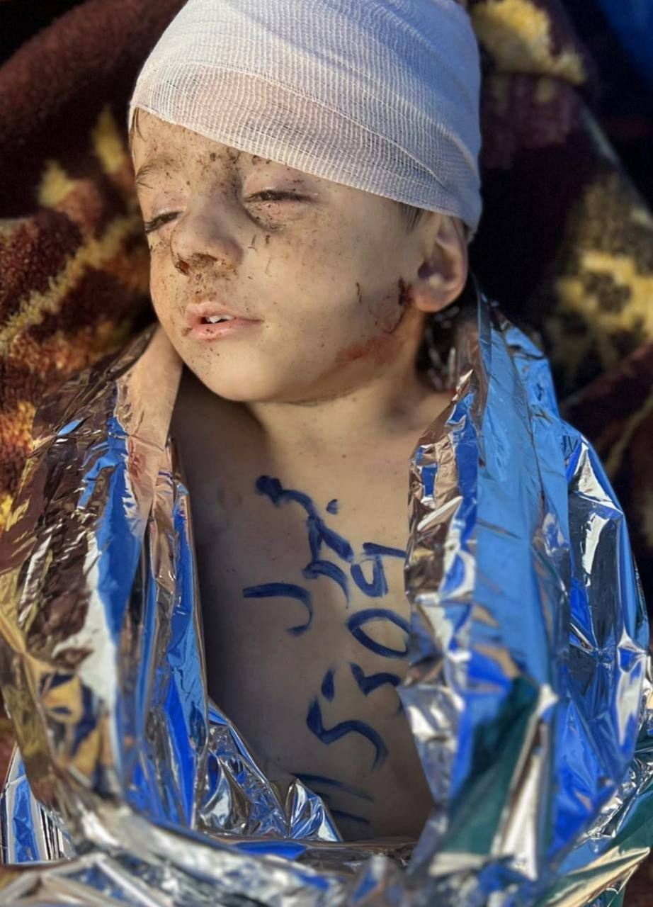 طفل شهيد مجهول في المجزرة التي ارتكبها الاحتلال الإسرائيلي بقصف المستشفى المعمداني