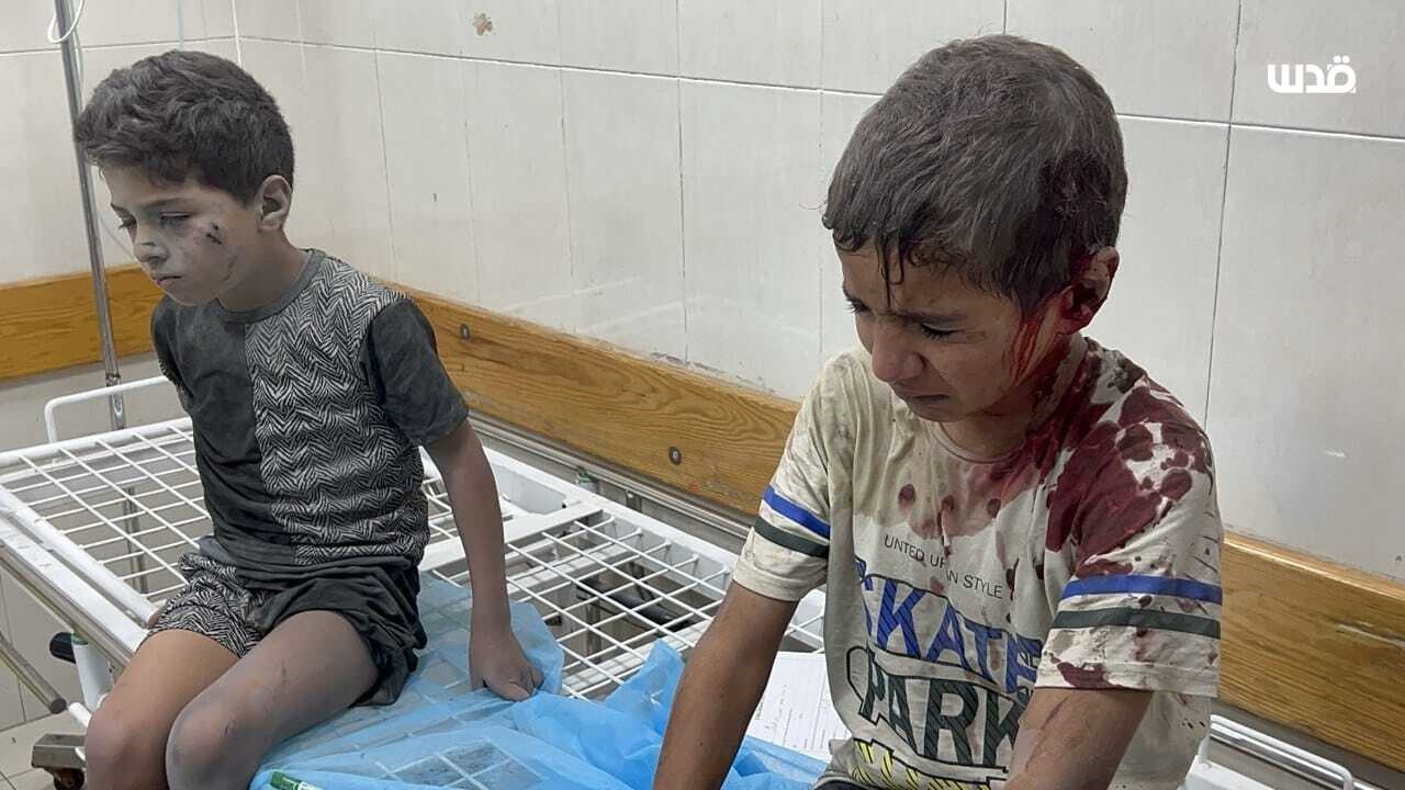 إصابات تصل إلى المستشفيات بعد مجزرة جديدة نفذها طيران الاحتلال في خانيونس