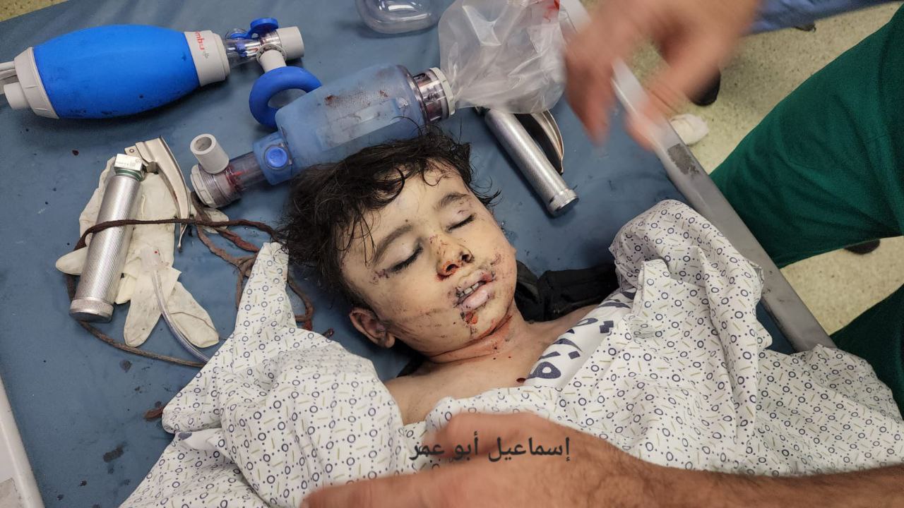 وصول 22 شهيد وأكثر من 16 إصابة أغلبهم من الأطفال إثر قصف طائرات الاحتلال الإسرائيلي لمنازل المواطنين على رؤوس ساكنيها جنوب قطاع غزة