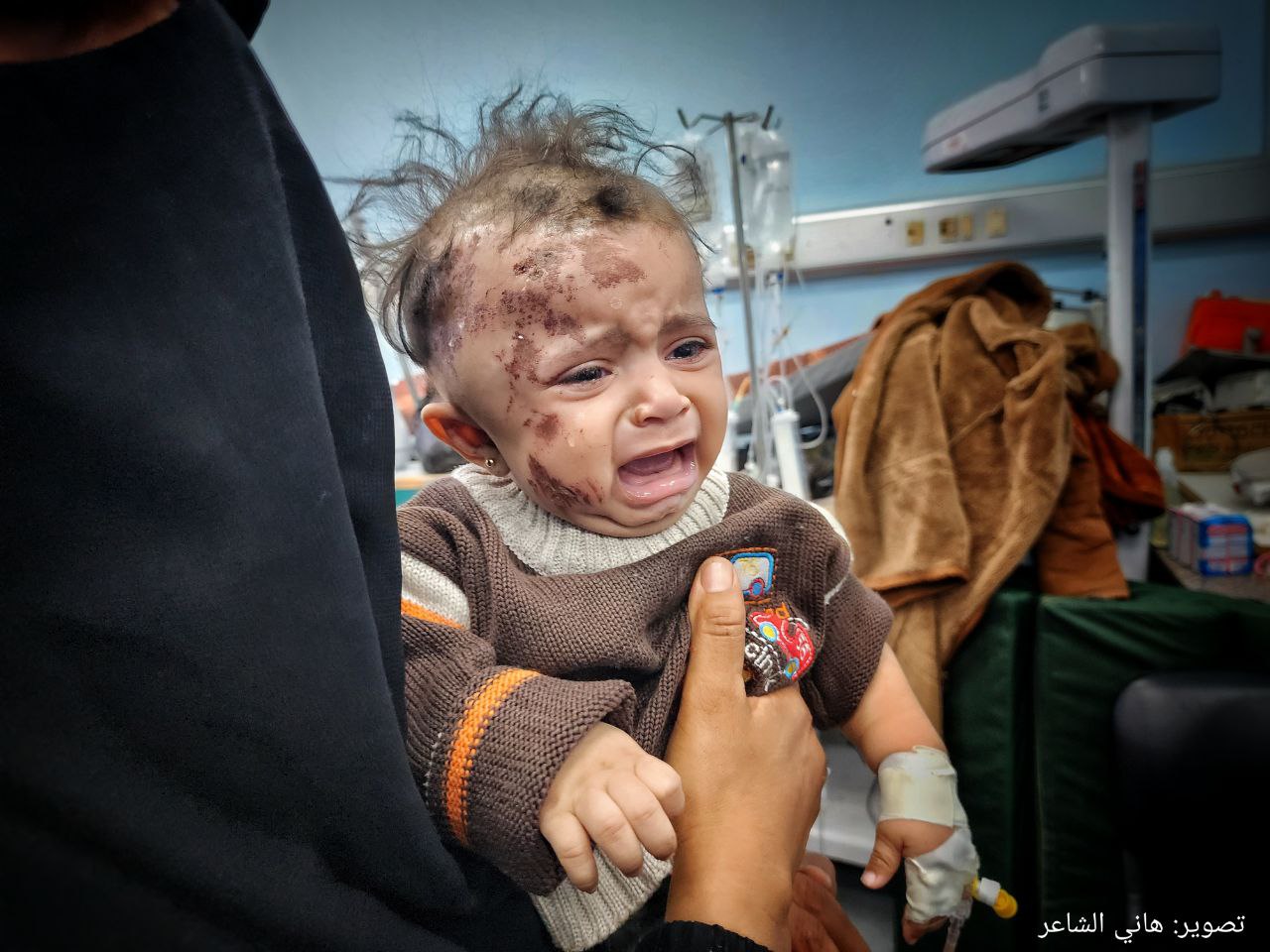 معلولیت های دائم کودکان فلسطینی در نتیجه حملات اشغالگران به غزه + تصاویر 